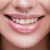 How to Get Dazzling Smile and Super-White Teeth?